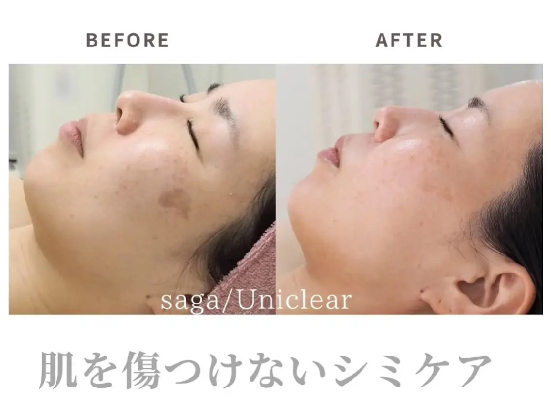 佐賀│男女エステ ユニクリアのエステ・リラクイメージ