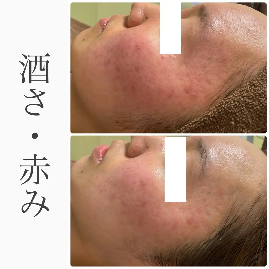 ハーブピーリング専門 BIOEL横浜のエステ・リラクイメージ
