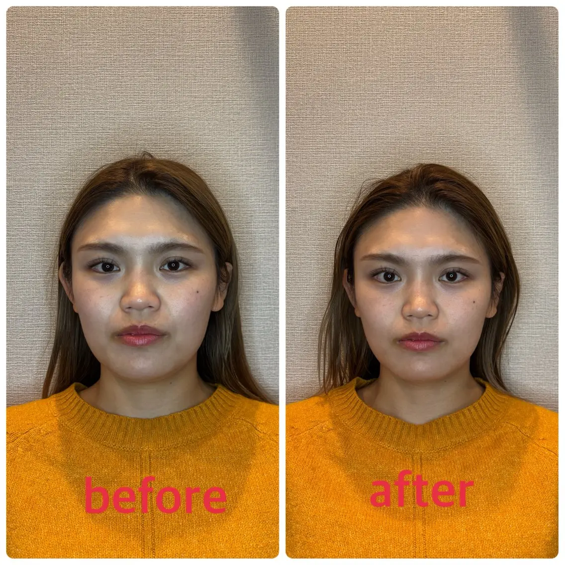 小林整骨院本町 美容鍼roomのエステ・リラクイメージ