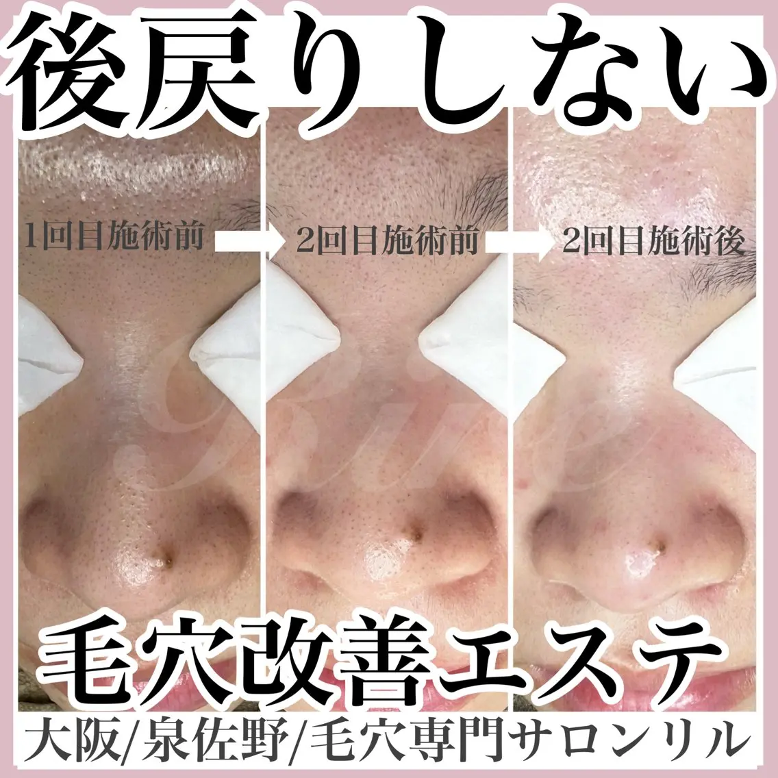 隅田 都布子のマツエク・マツパデザイン