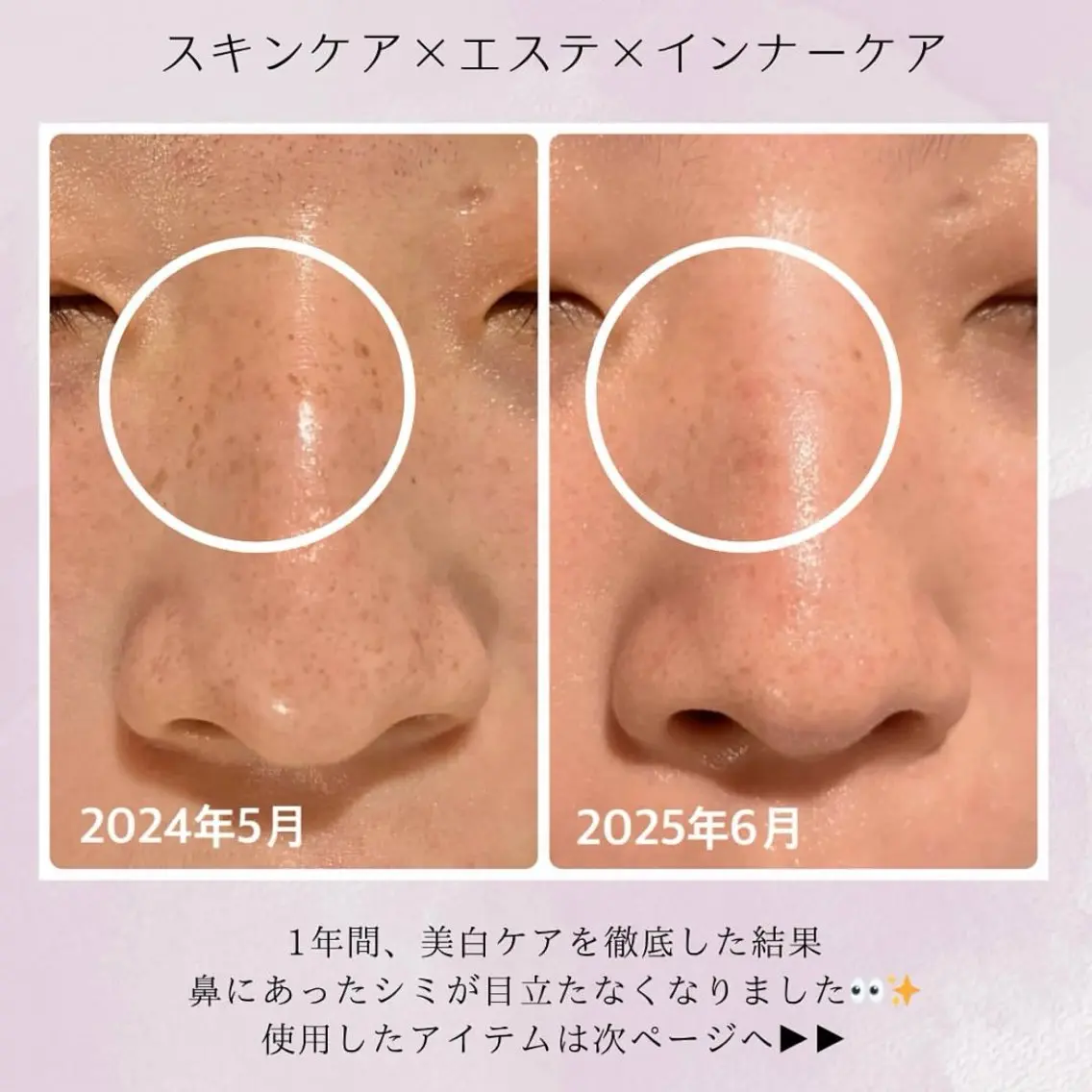 ナリス化粧品 Yumenaのエステ・リラクイメージ