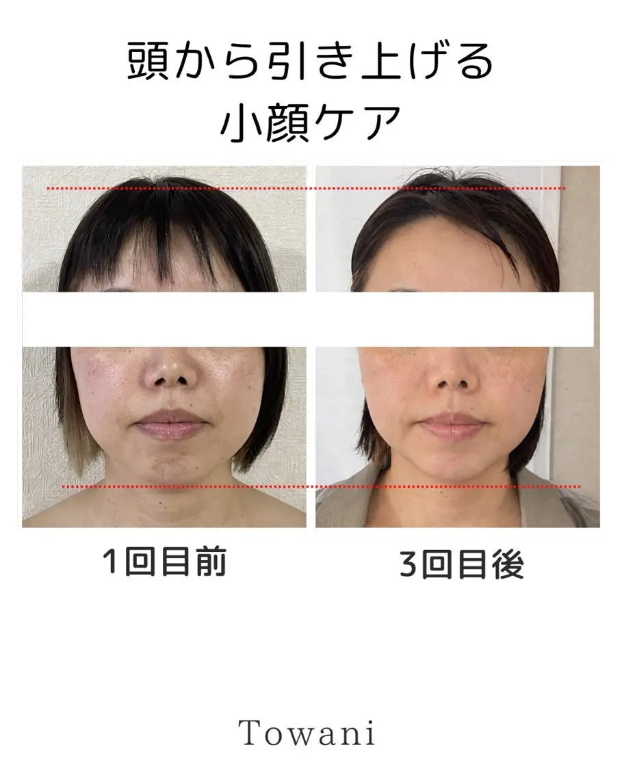 Towani 小顔・ビタミンケアのエステ・リラクイメージ