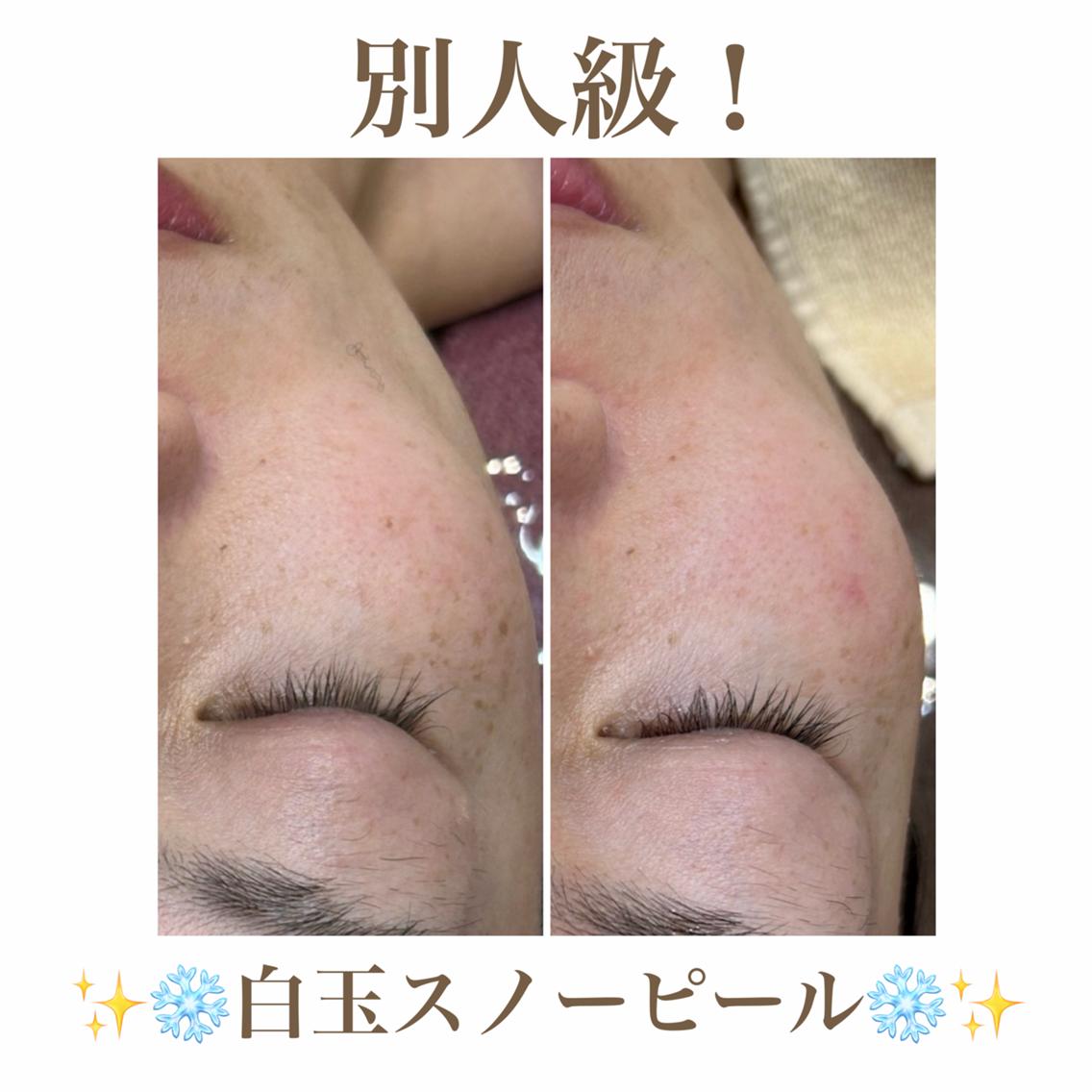 エステ 🫧美肌サロン🫧 レイビスひかる🧡のエステ・リラクイメージ