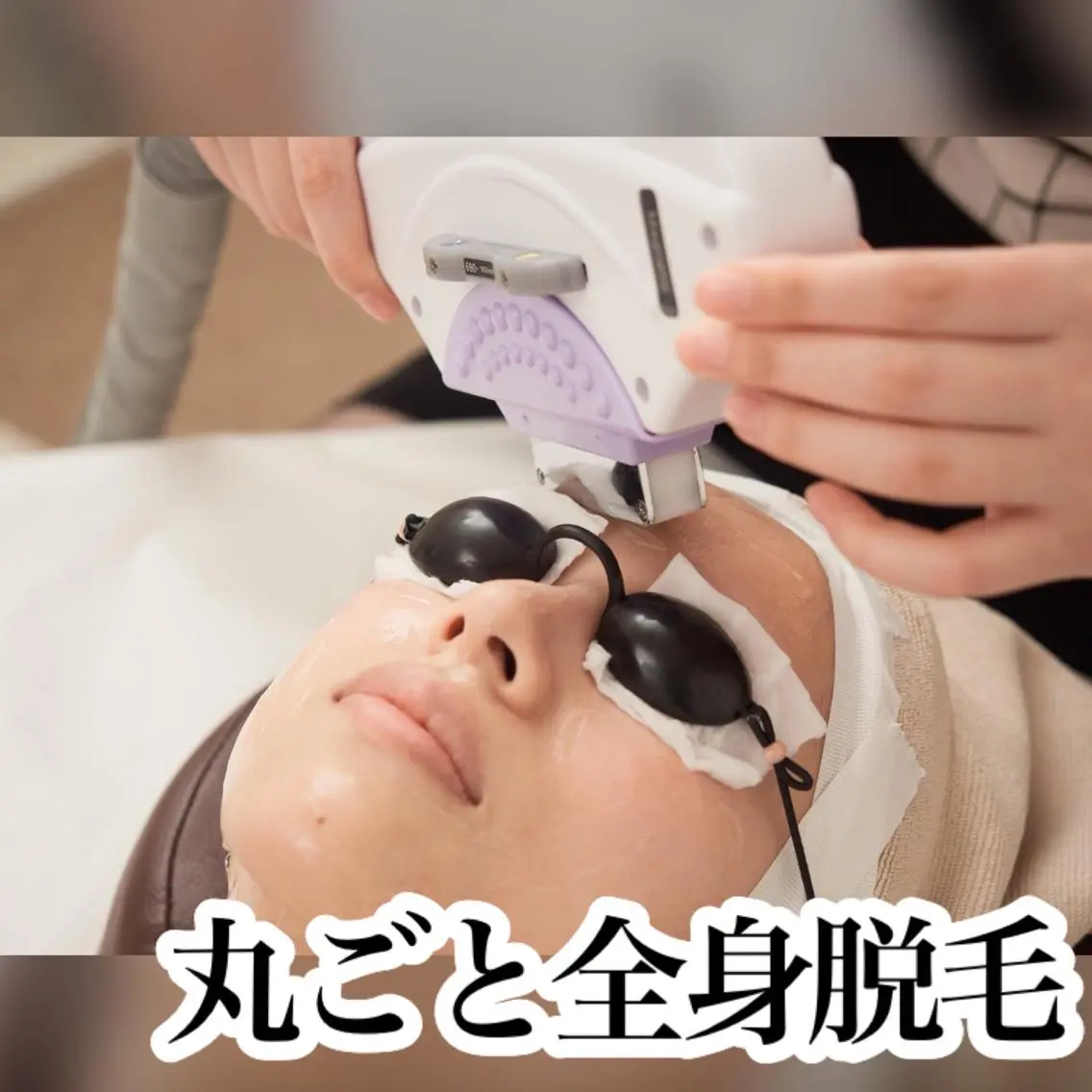 🍠1日2名限定🍠SHR丸ごと全身脱毛💜無料カウンセリング付き/の写真