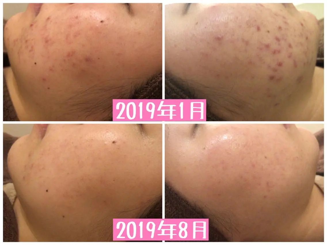 ショート カラー パーマ ヘアアレンジ メンズ キッズ ネイル マツエク・マツパ エステ リラク ニキビ・肌質改善専門 ♡人生が変わるサロンのエステ・リラクイメージ