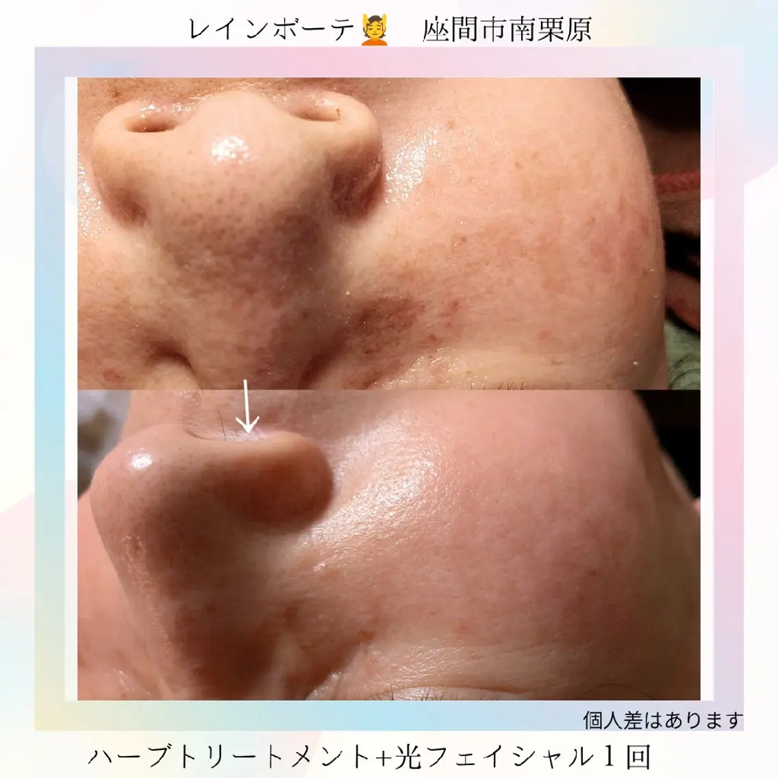 エステ 肌管理よもぎ蒸し脱毛 レインボーテ座間のその他イメージ
