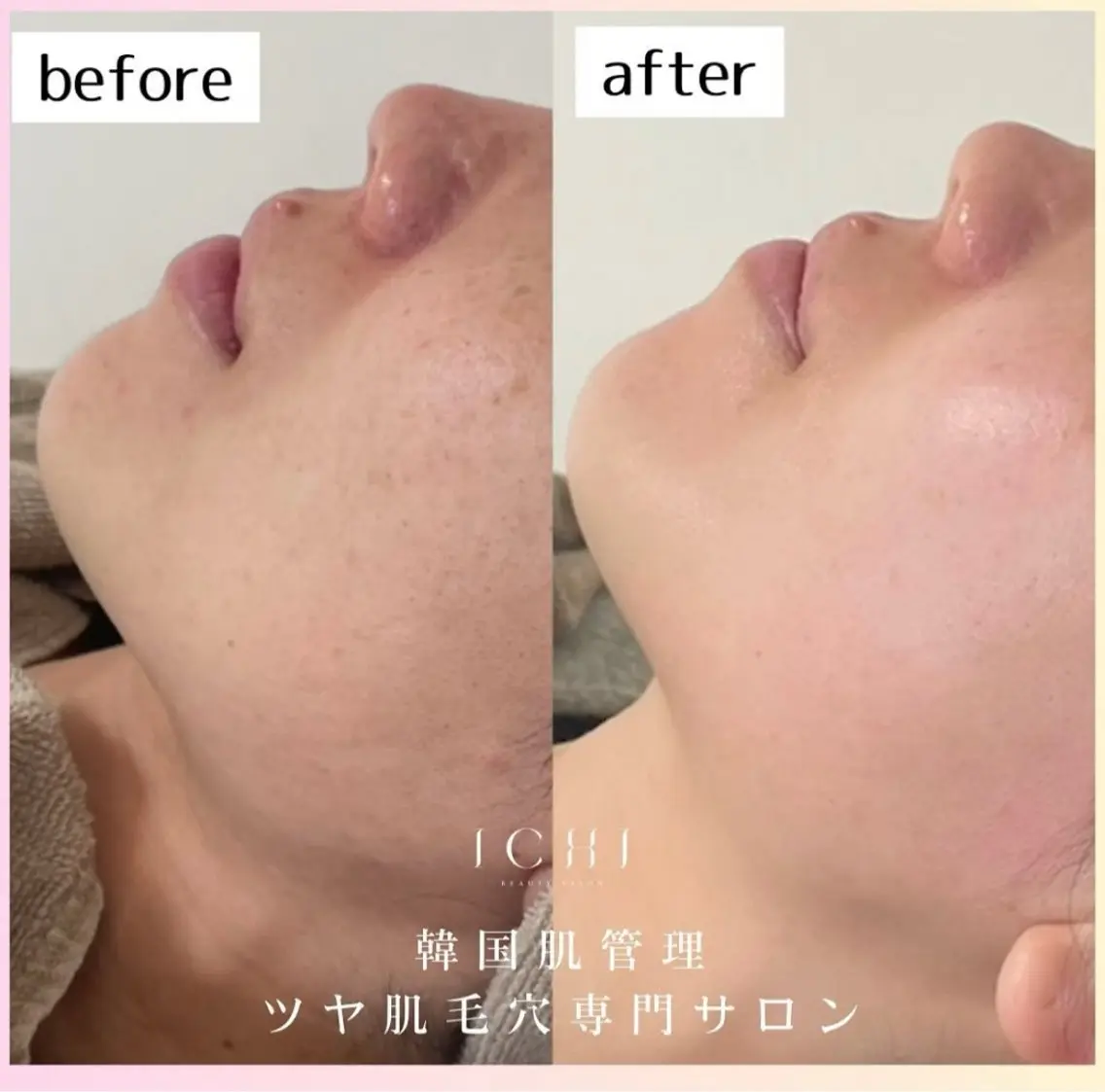 【エステサロン】 ichi aoiのエステ・リラクイメージ