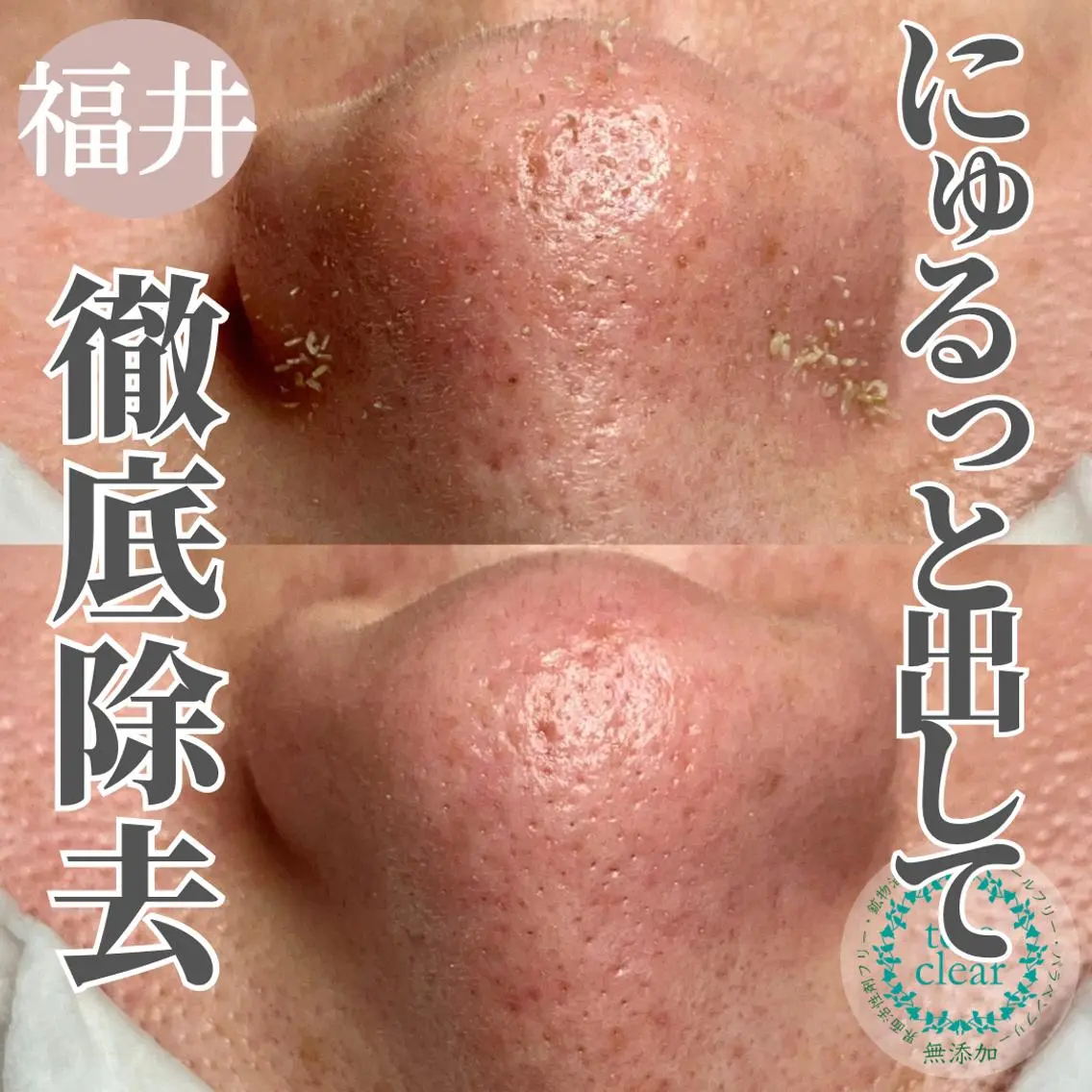 毛穴肌質ケアサロン Yourmeユアミーのエステ・リラクイメージ