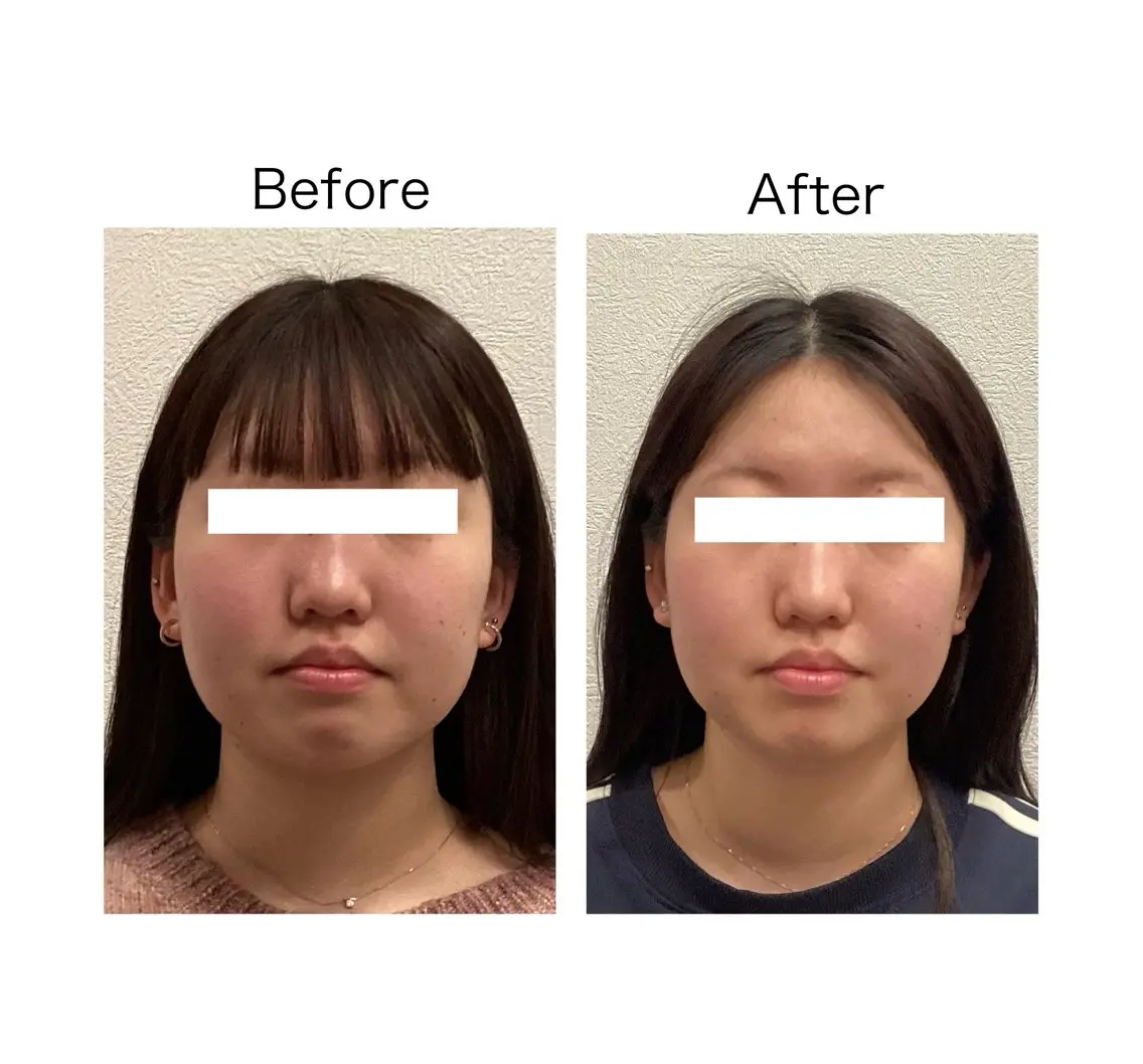 エステ 小顔サロン sharpのエステ・リラクイメージ