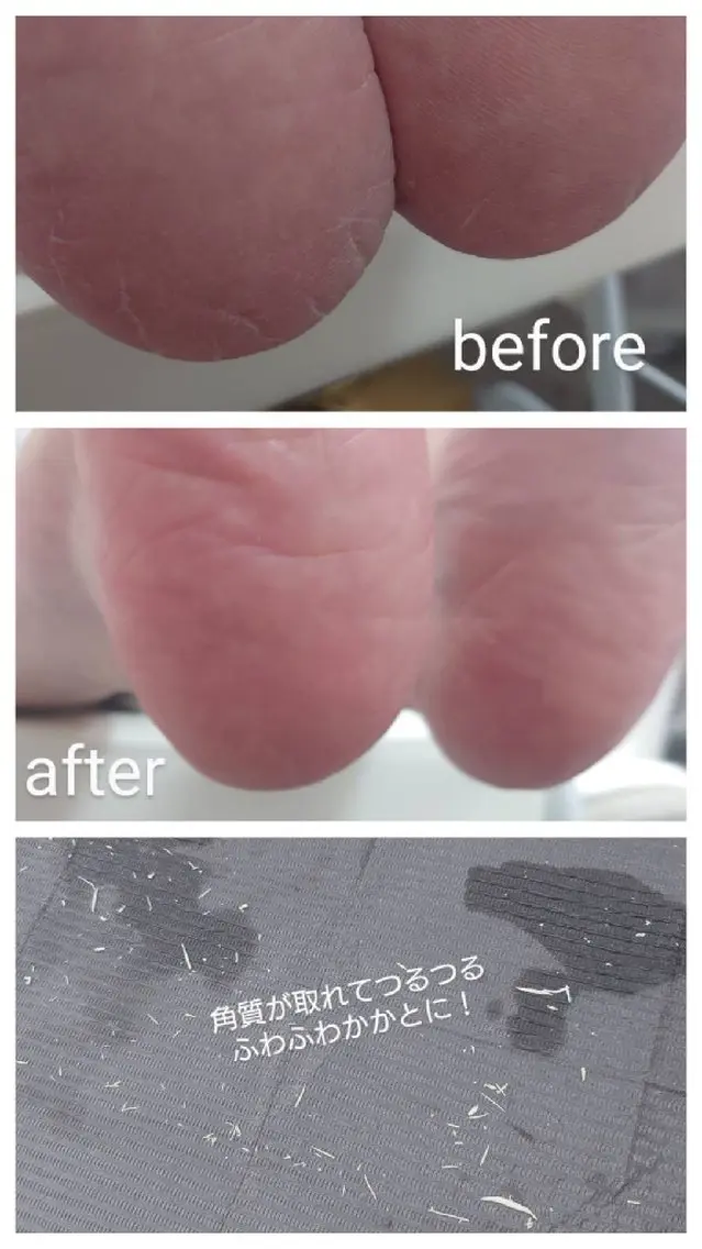 つるふわかかとケアの写真