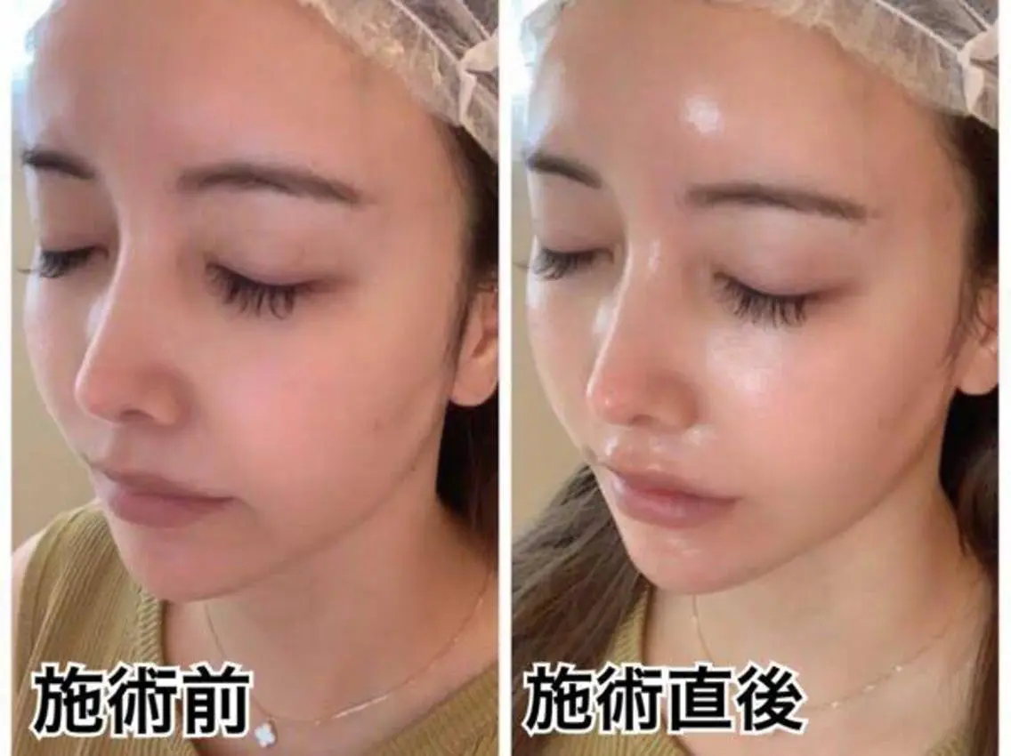 エステ BestBelleꕤ 大阪福島/肌質改善のエステ・リラクイメージ