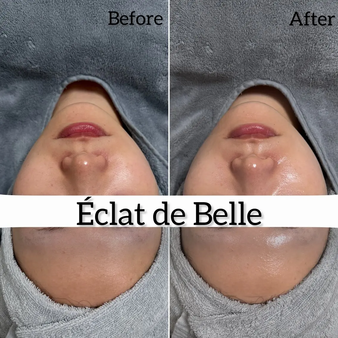 その他 Éclat de Belle🫧白玉肌のその他イメージ