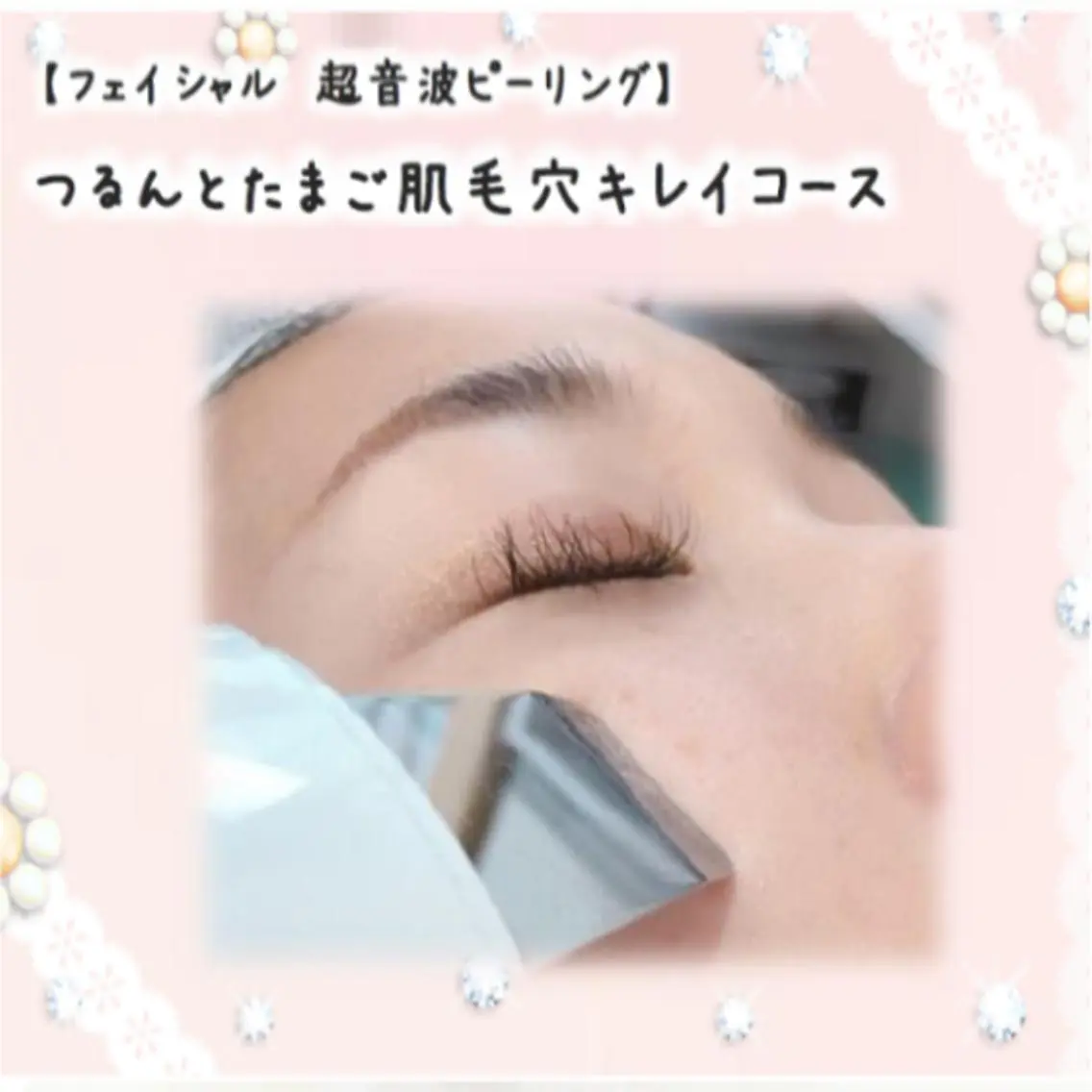 [人気No.1]!超音波の力で毛穴レス【つるんとたまご肌毛穴洗浄】8,800→6,600の写真