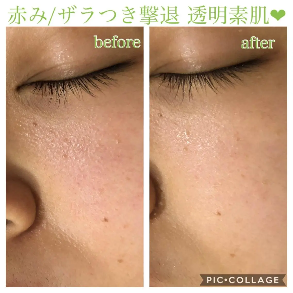 ミディアム カラー パーマ ヘアアレンジ キッズ ネイル マツエク・マツパ エステ リラク EnsorClair 代表　野口真央のエステ・リラクイメージ