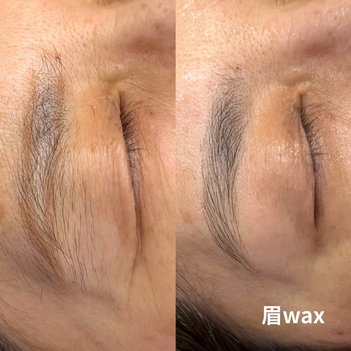眉wax脱毛【アートメイク看護師デザイン付】の写真