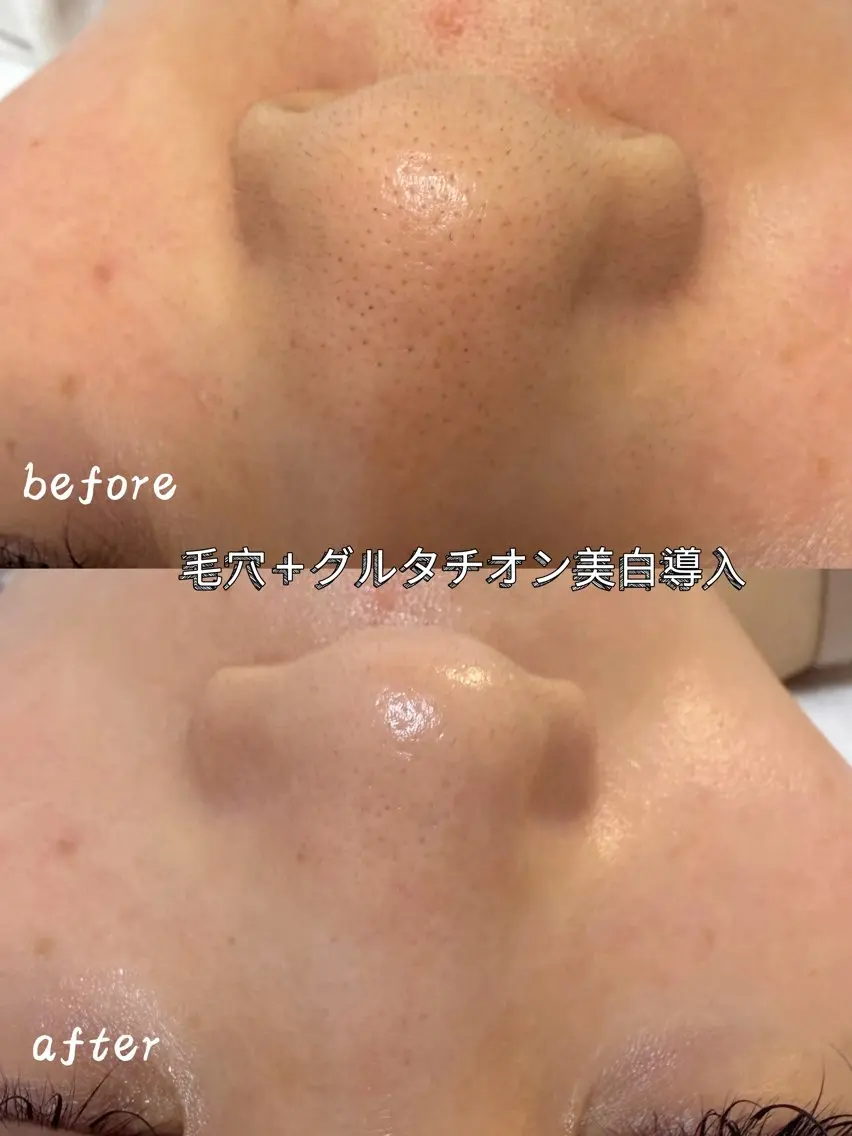 その他 Nature Souce毛穴専門店のその他イメージ
