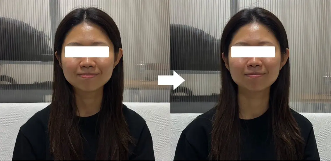 【4月5月お誕生日の方限定】ヘッドマッサージ1500円💆♀️の写真