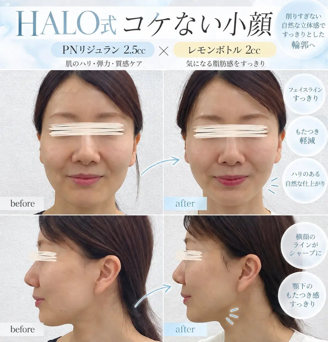 エステ 小顔痩身HALO 二宮早織のエステ・リラクイメージ