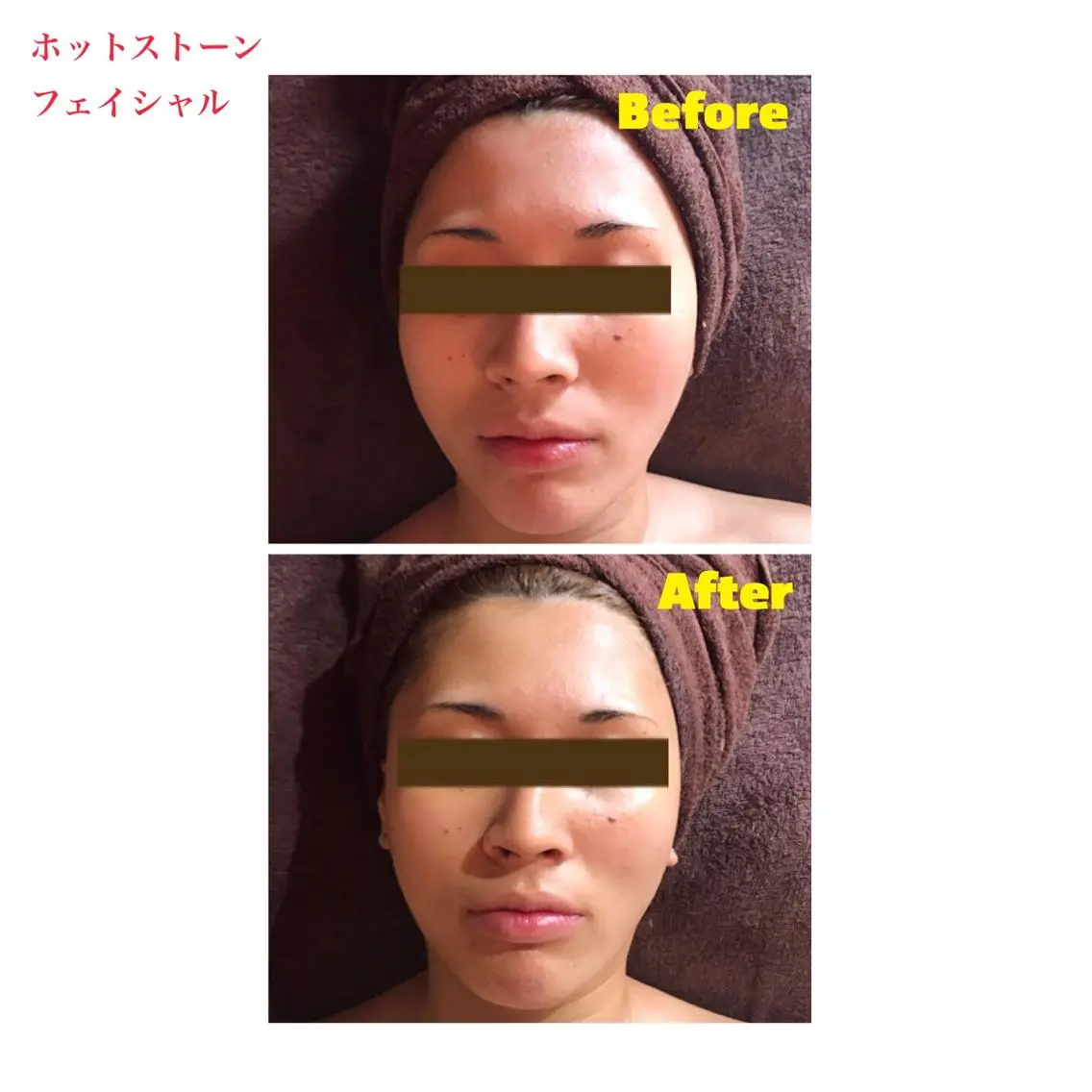 代表 MOMOのエステ・リラクイメージ