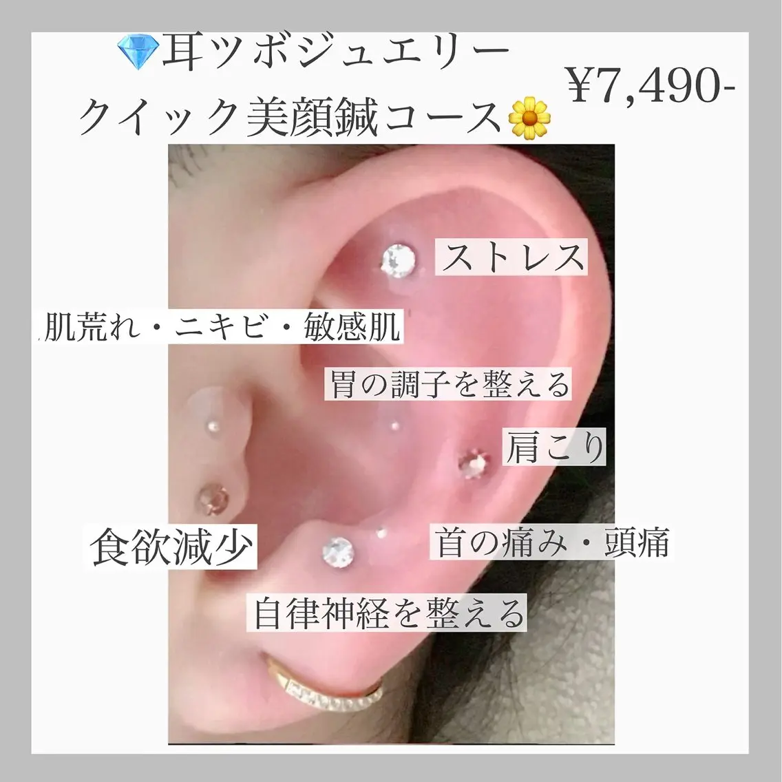 🌼耳つぼジュエリー+クイック美容鍼🌼 ヘッドマッサージ付き 耳つぼ▶︎両耳合わせて14粒の写真
