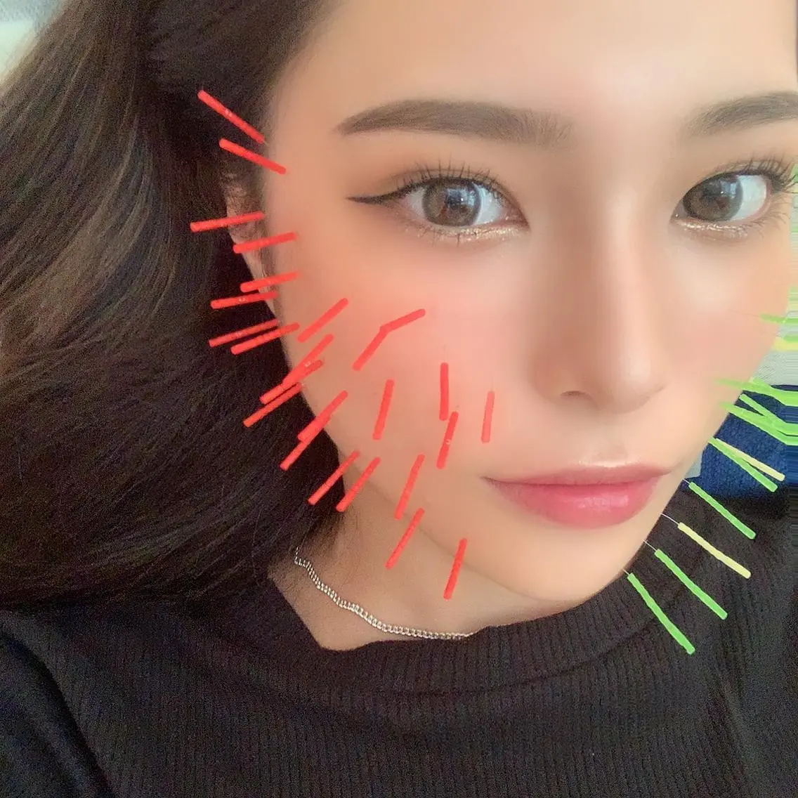 鍼灸 Refineのその他イメージ
