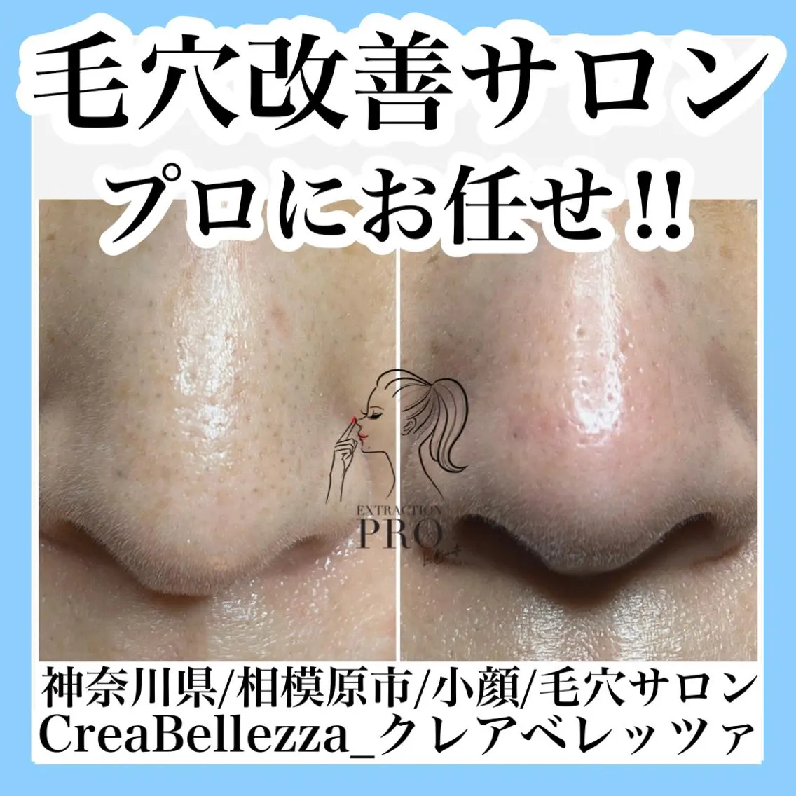 学生/新社会人の方向け✨化粧ノリUP!肌つるんつるんコース⭐️の写真