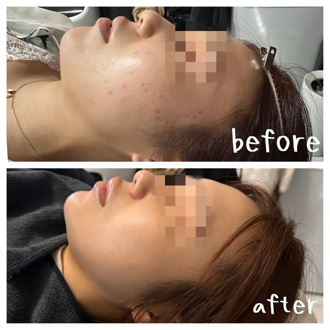 エステ Beauty sal on Renみのりのエステ・リラクイメージ