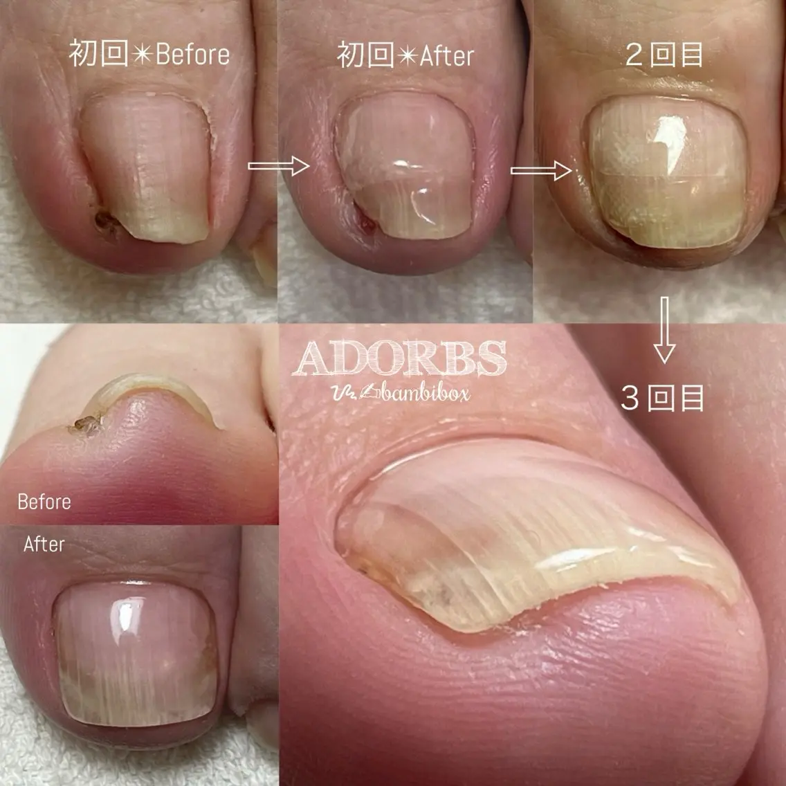 ネイル ジェルネイル フットネイル ADORBS ✩上福岡のネイルデザイン