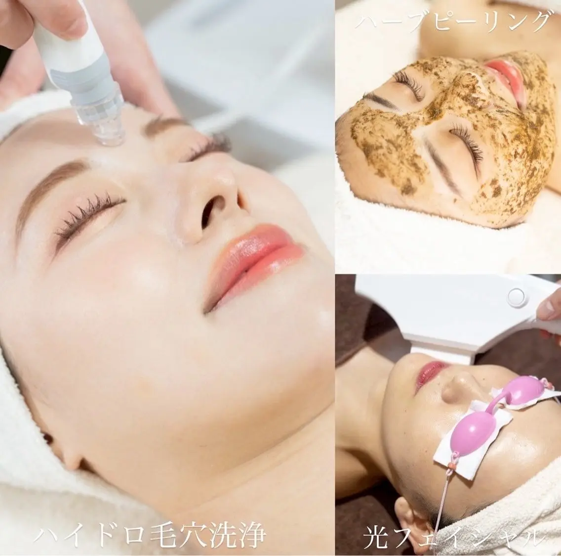 肌管理！スペシャル美肌コース💆🏻‍♀️🌼の写真