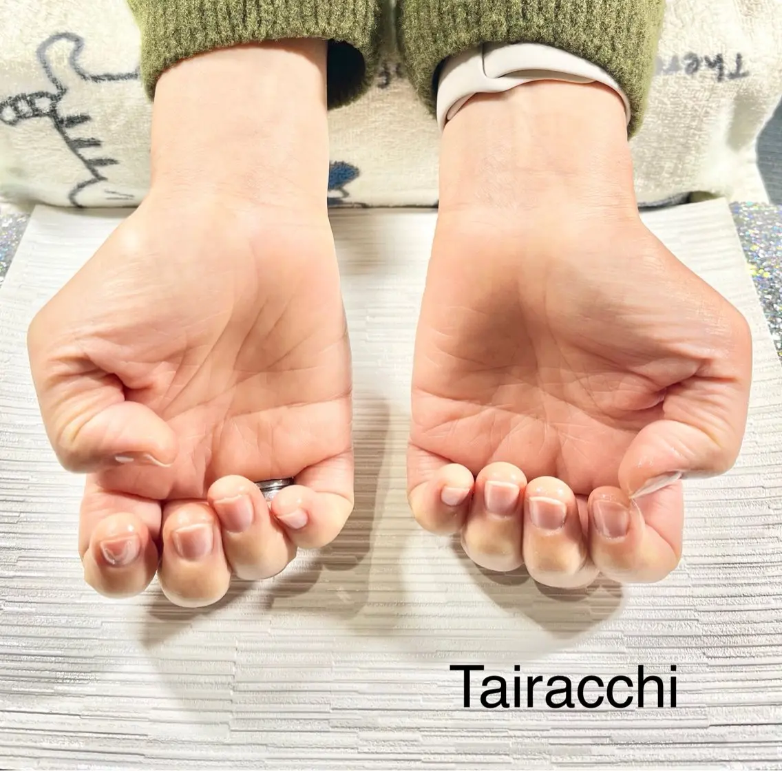 ネイル ラメ(グリッター) ハンドケア Tairacchi ﾀｲﾗｯﾁのエステ・リラクイメージ