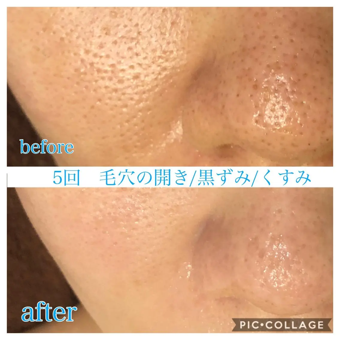 ロング カラー パーマ ヘアアレンジ キッズ ネイル マツエク・マツパ エステ リラク EnsorClair 代表 野口真央のエステ・リラクイメージ