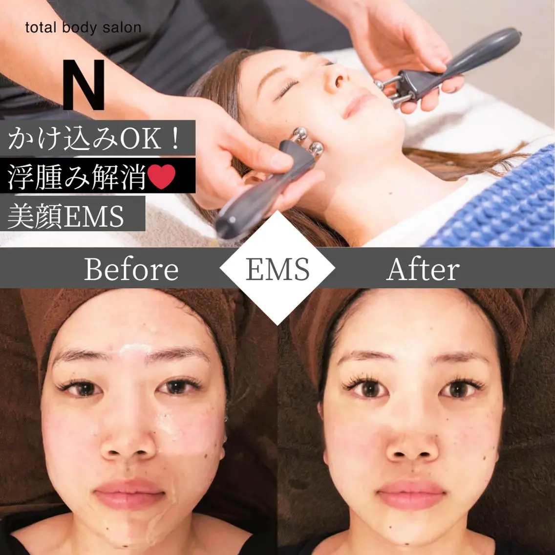 【minimo限定✨大事な予定前に即効むくみ&贅肉撃退🔥】 美顔EMS(50分) 通常11,000円 → 4,500円の写真