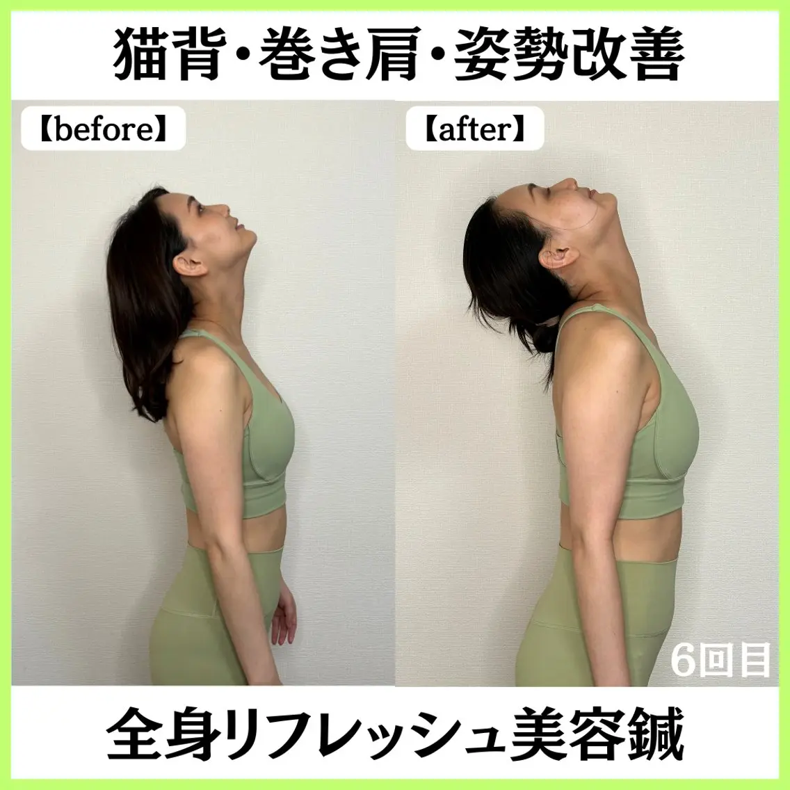 美容鍼サロン ボディコンディションのエステ・リラクイメージ