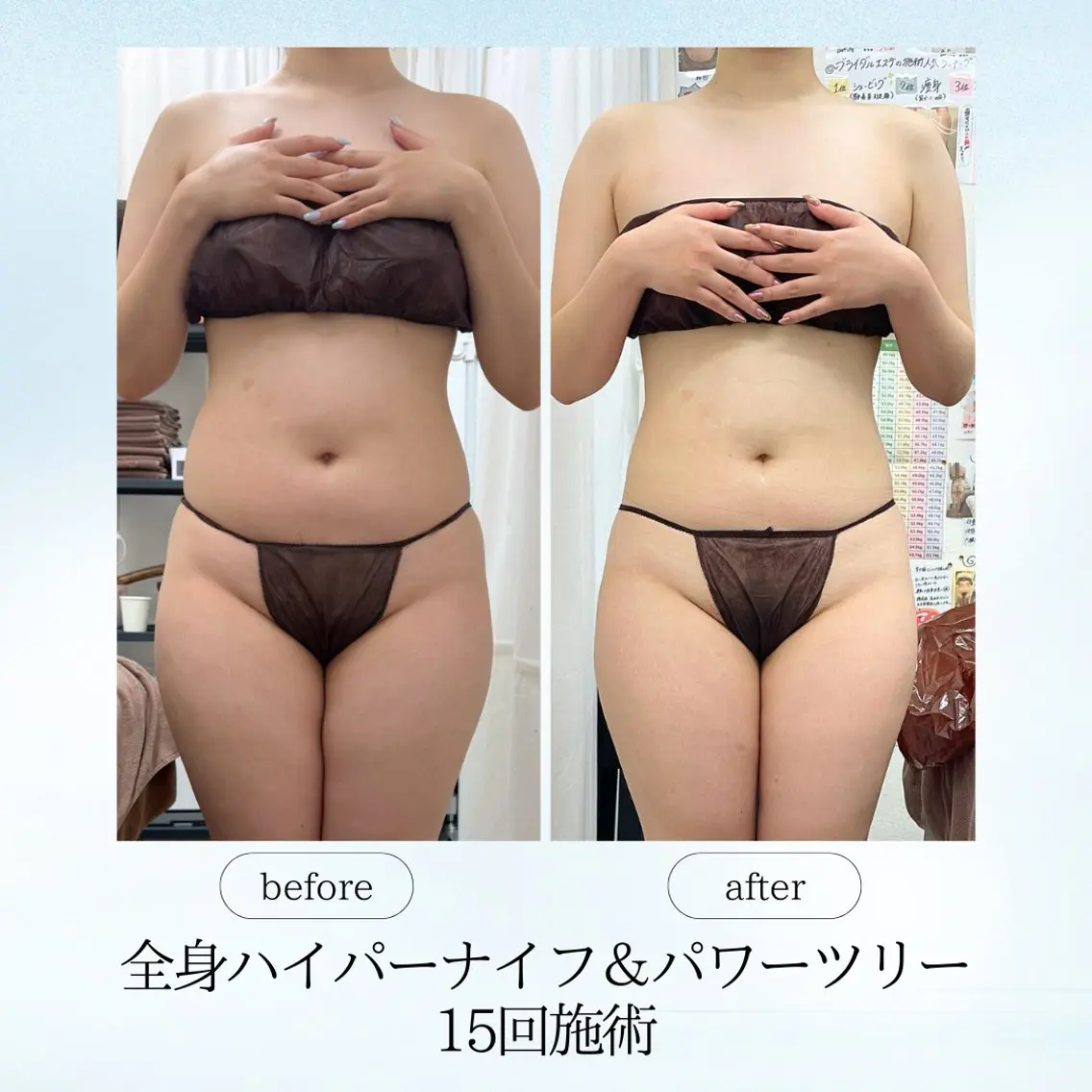エステ リラク 《痩身、小顔専門店》 エスプレッソのエステ・リラクイメージ