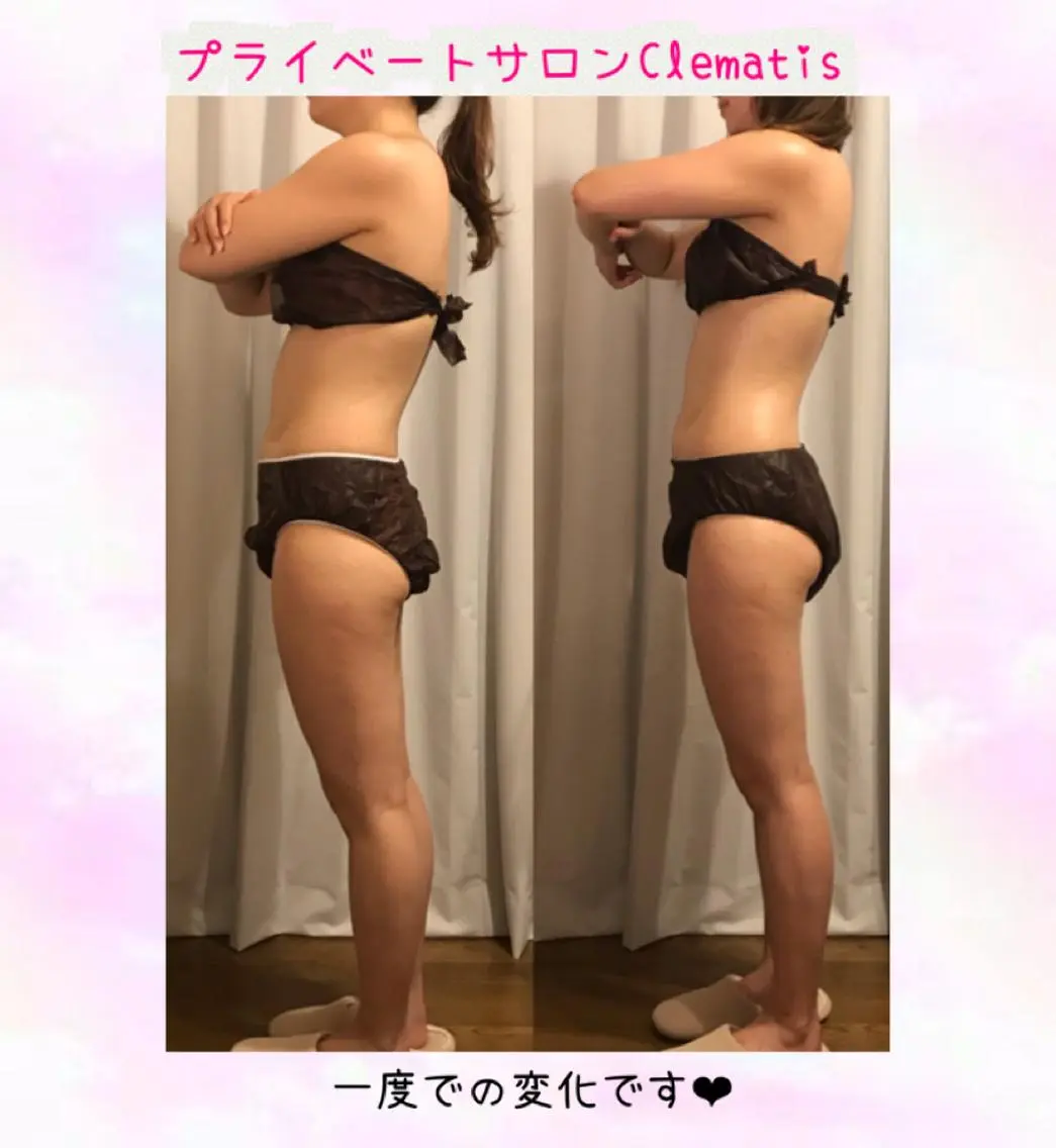 ロング カラー パーマ ヘアアレンジ メンズ キッズ ネイル マツエク・マツパ 強圧オールハンド痩身 片野のエステ・リラクイメージ