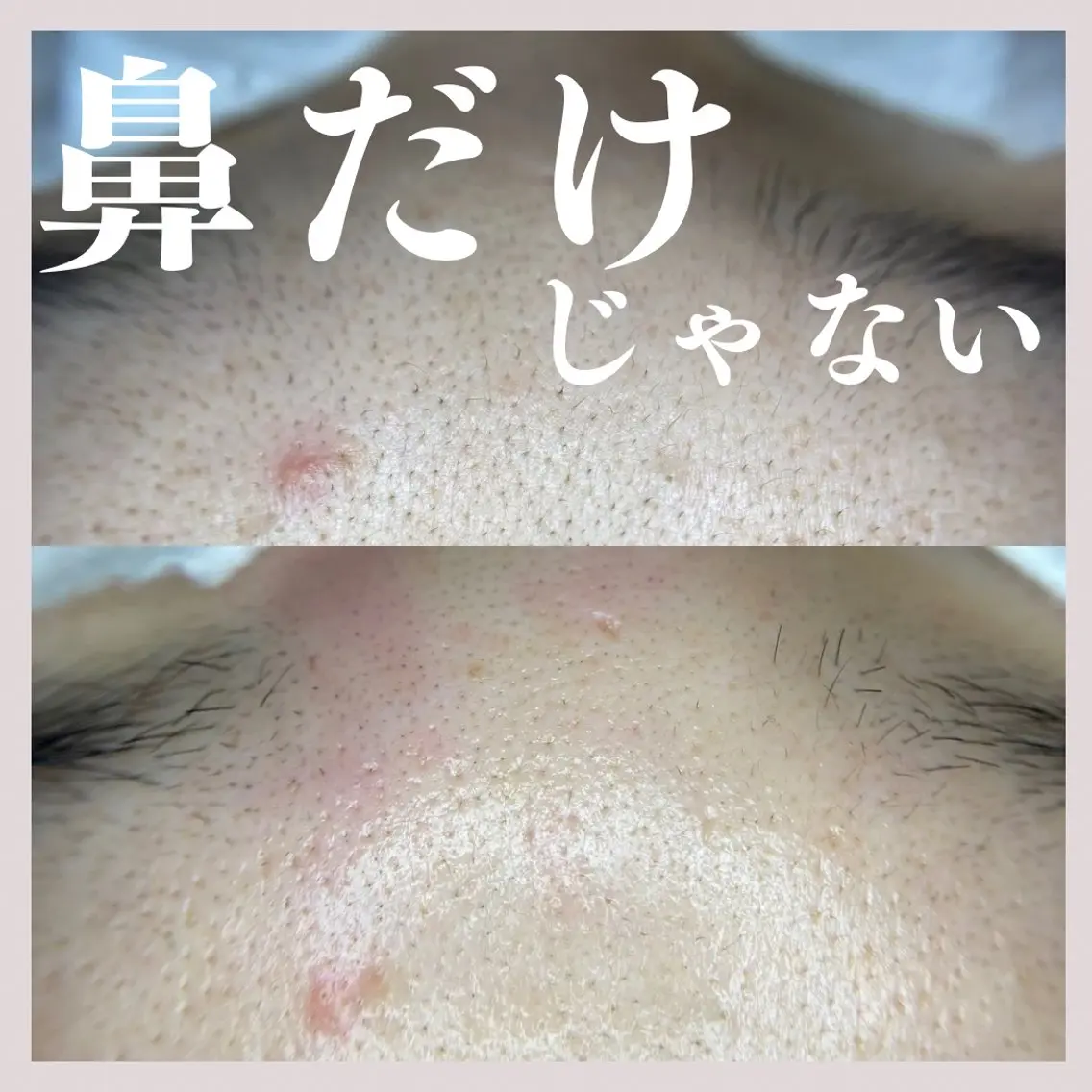 エステ salon MUSUBUのエステ・リラクイメージ