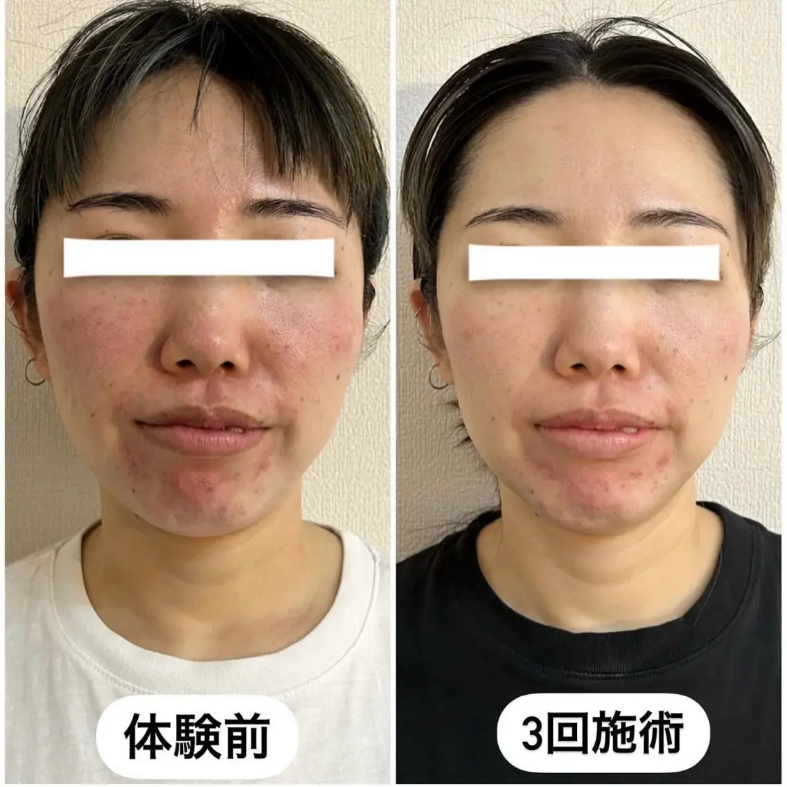 エステ 肌管理 OGUMOのエステ・リラクイメージ