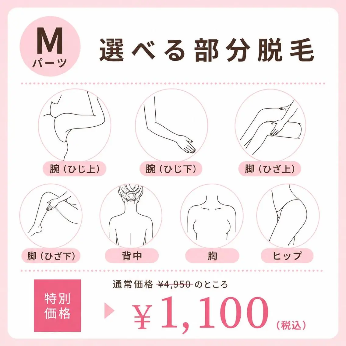 【7月限定】選べるMパーツ脱毛(女性)¥4,950→¥1,100の写真