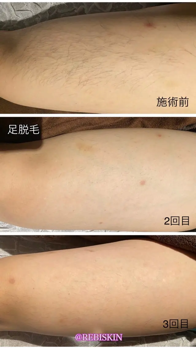 冷えむくみ改善専門 REBISKIN🌿のその他イメージ