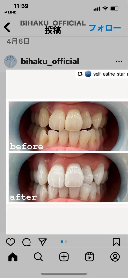 WHITENING ハウスのマツエク・マツパデザイン
