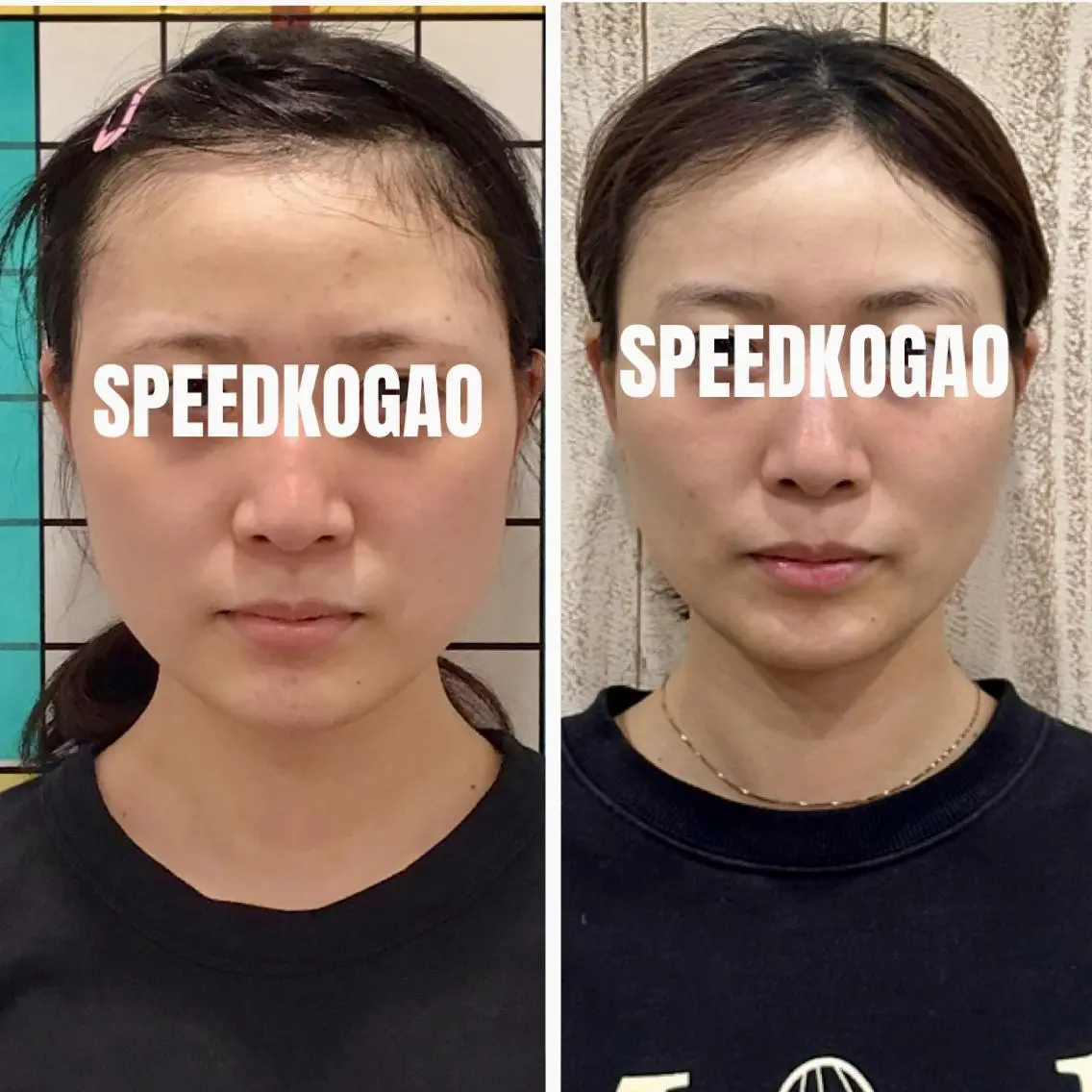 エステ リラク 小顔矯正Speed KOGAO渋谷本店のエステ・リラクイメージ