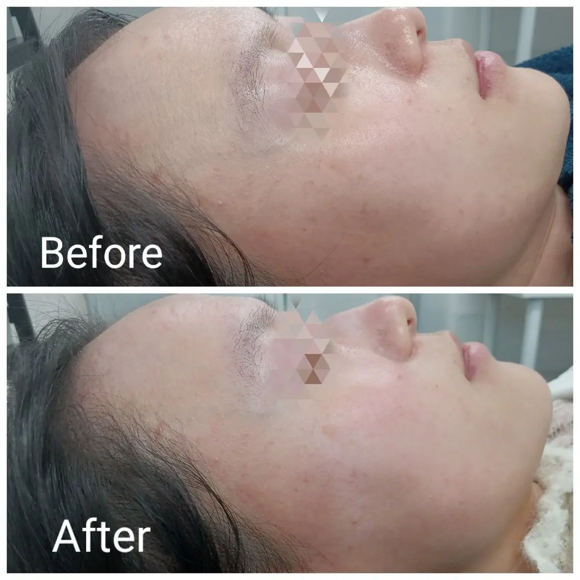 エステ リラク 肌質改善Beauty salon Renのエステ・リラクイメージ