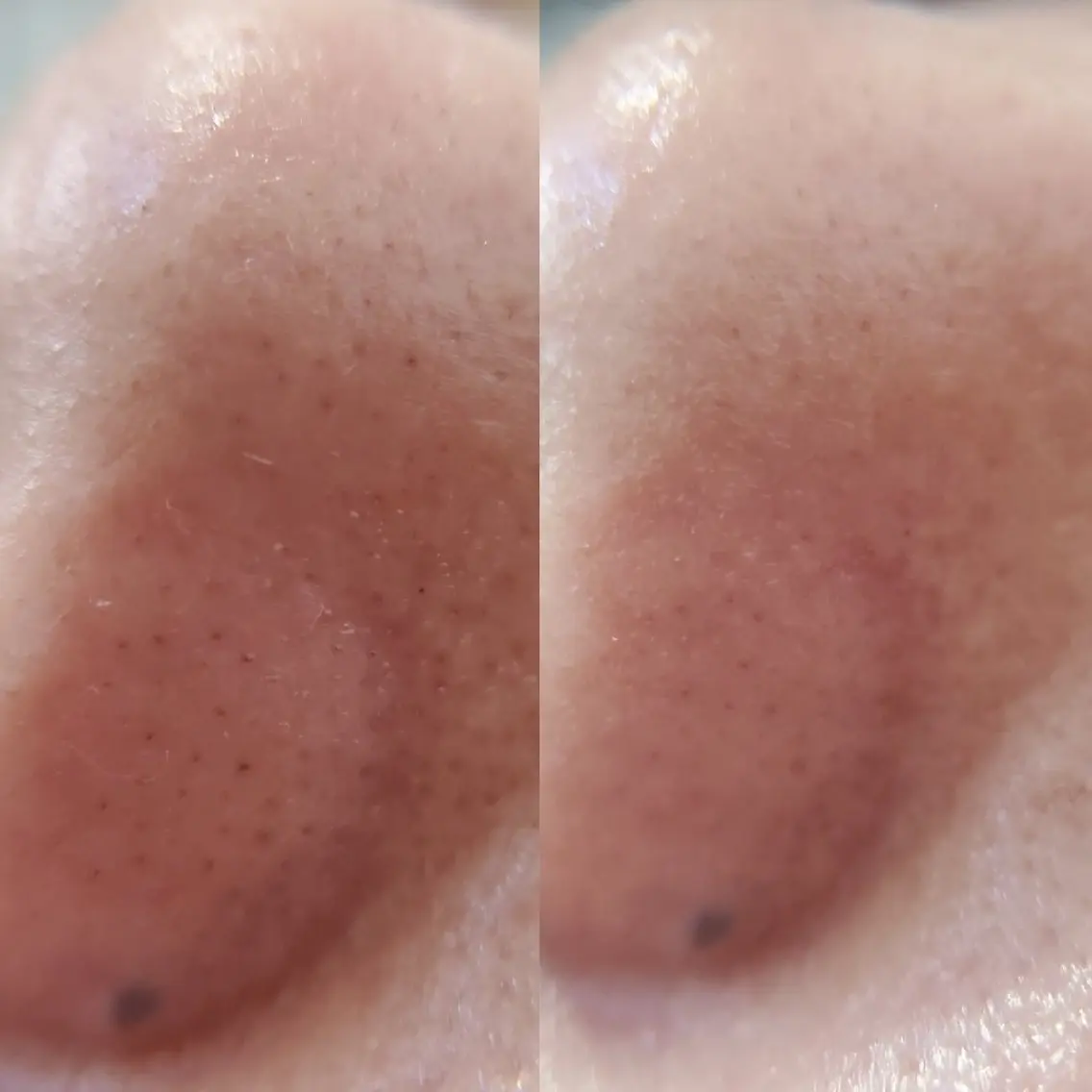 鼻WAXの写真