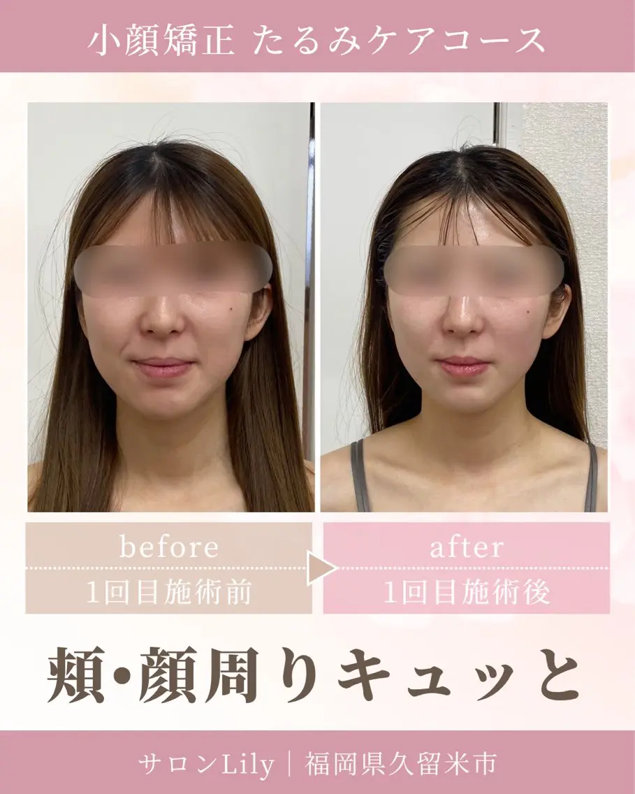 小顔矯正サロン Lilyのエステ・リラクイメージ