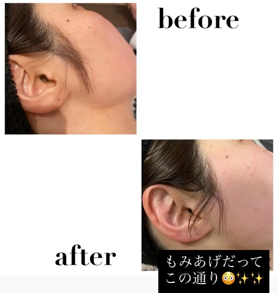 脱毛 なみ|WAX脱毛専門 店|さいたま市のエステ・リラクイメージ