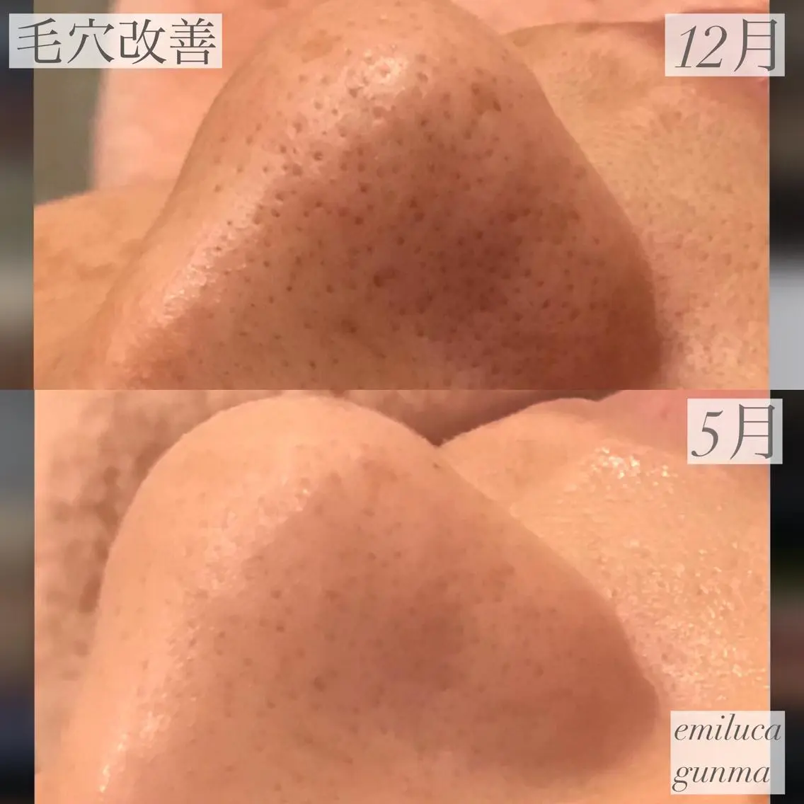 emiluca西目/ 脱毛/細胞美容のエステ・リラクイメージ