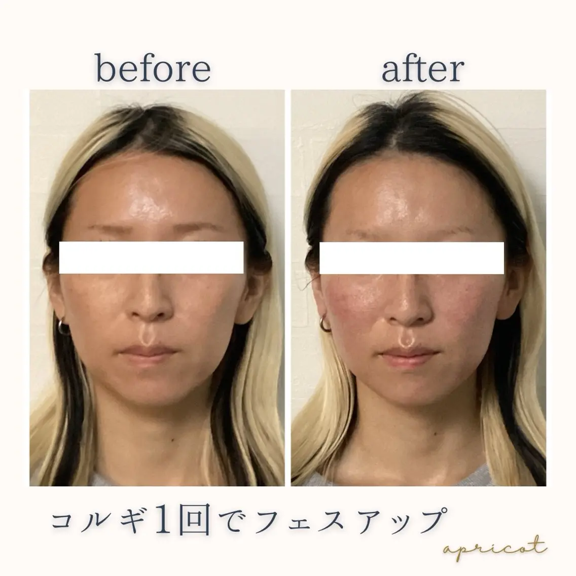 エステ リラク apricot Asukaのその他イメージ
