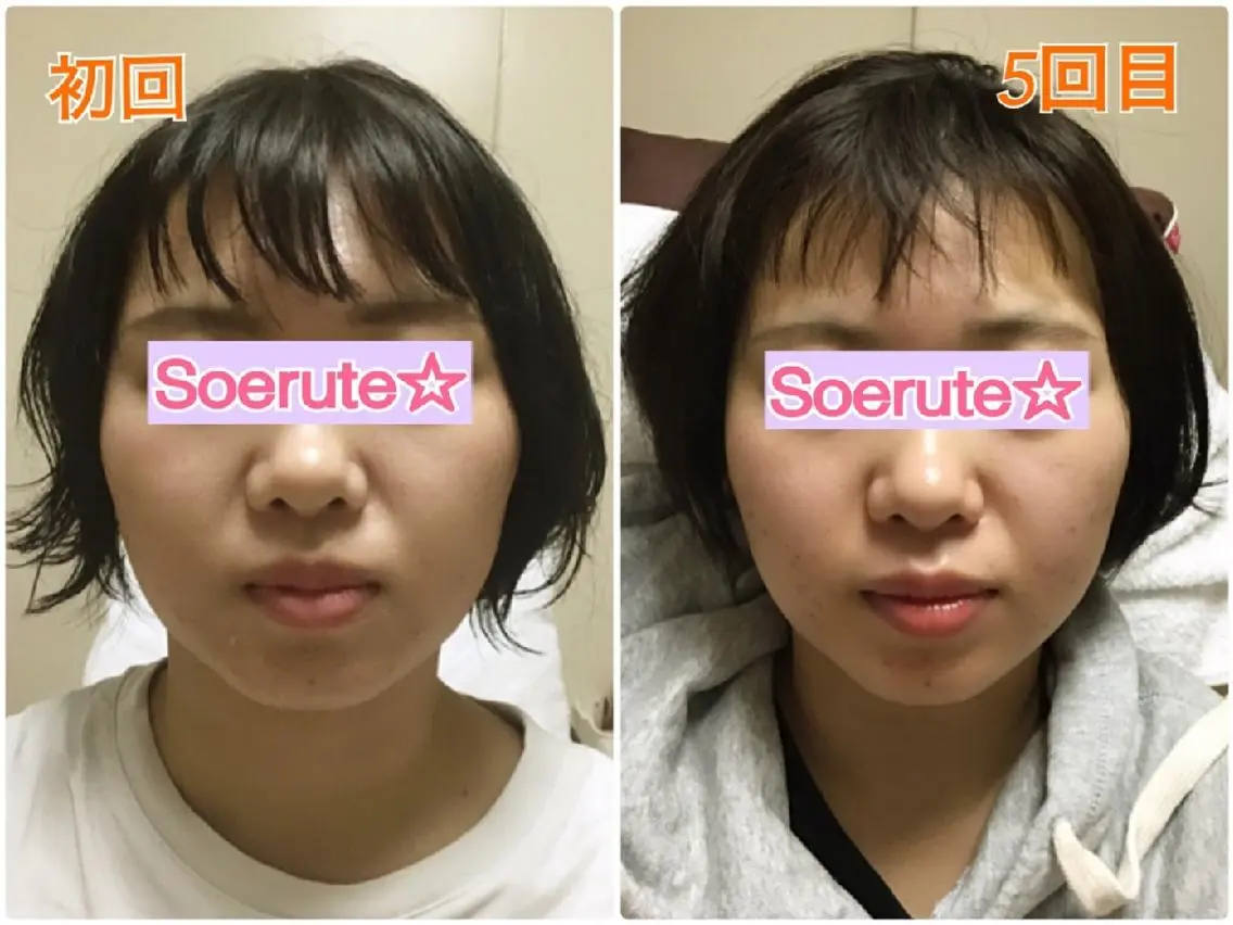 Soerute☆ ソエルテ 井上みえのエステ・リラクイメージ