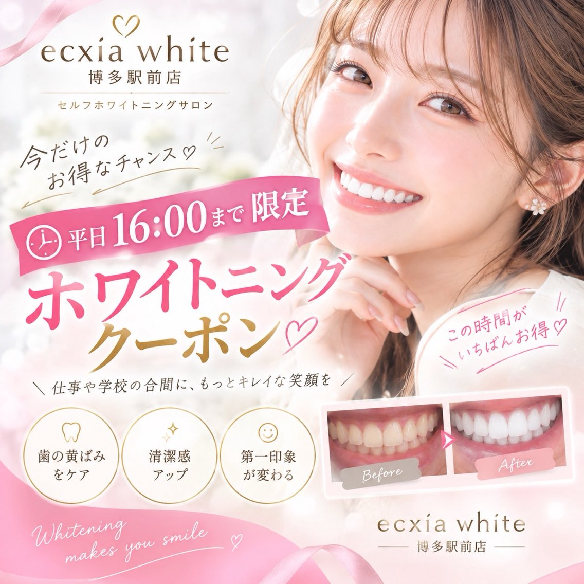 【平日限定/16時迄】セルフホワイトニング(9分×2セット)1回¥1600別途料金なしの写真