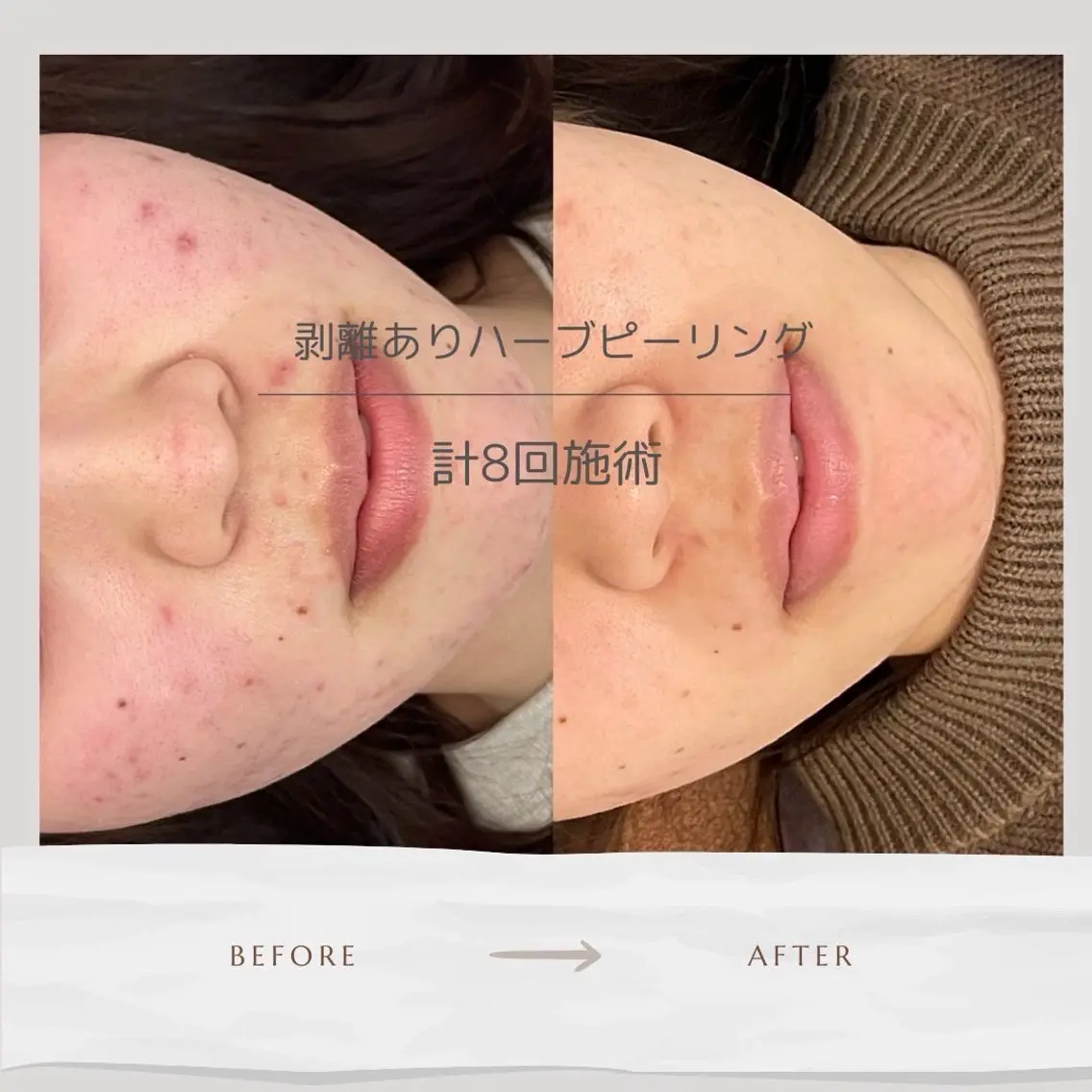 Life Salon別府店のエステ・リラクイメージ